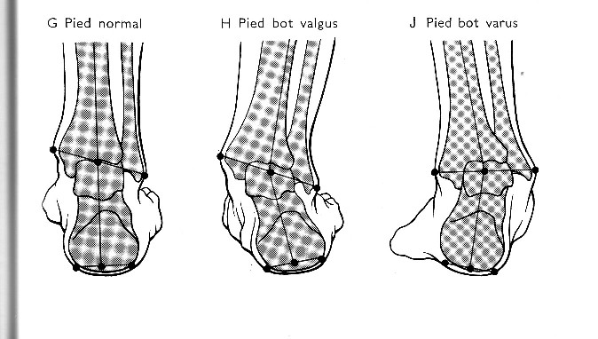 l-les-axesdu-talon.jpg (674Ã382)